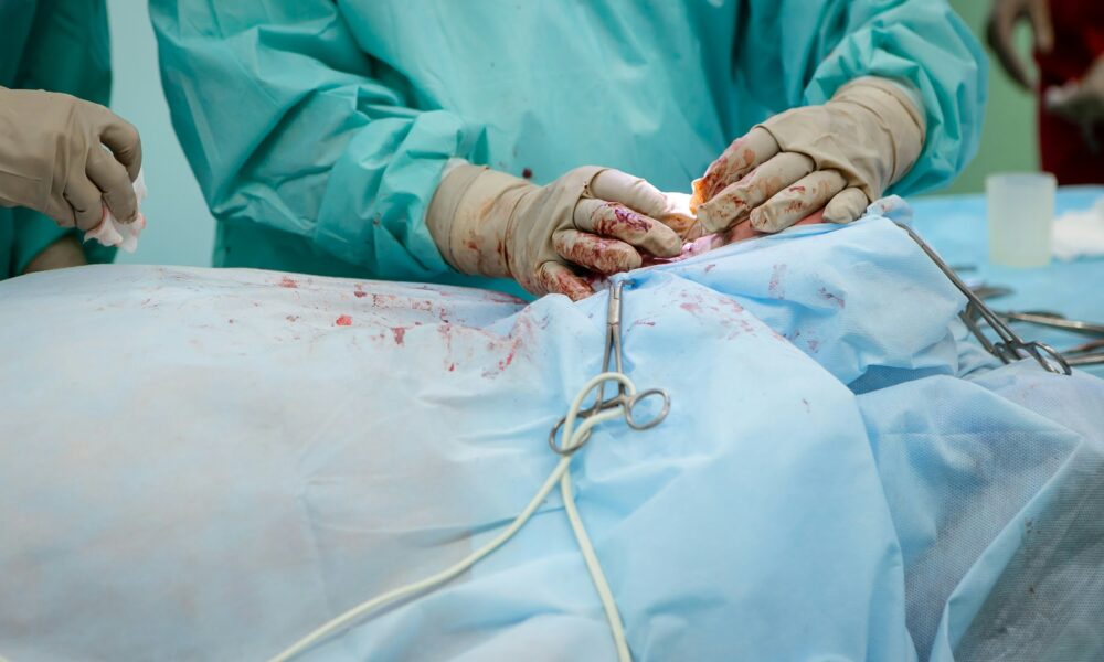 Best Practices for Minimizing Risk in Amputation Surgery