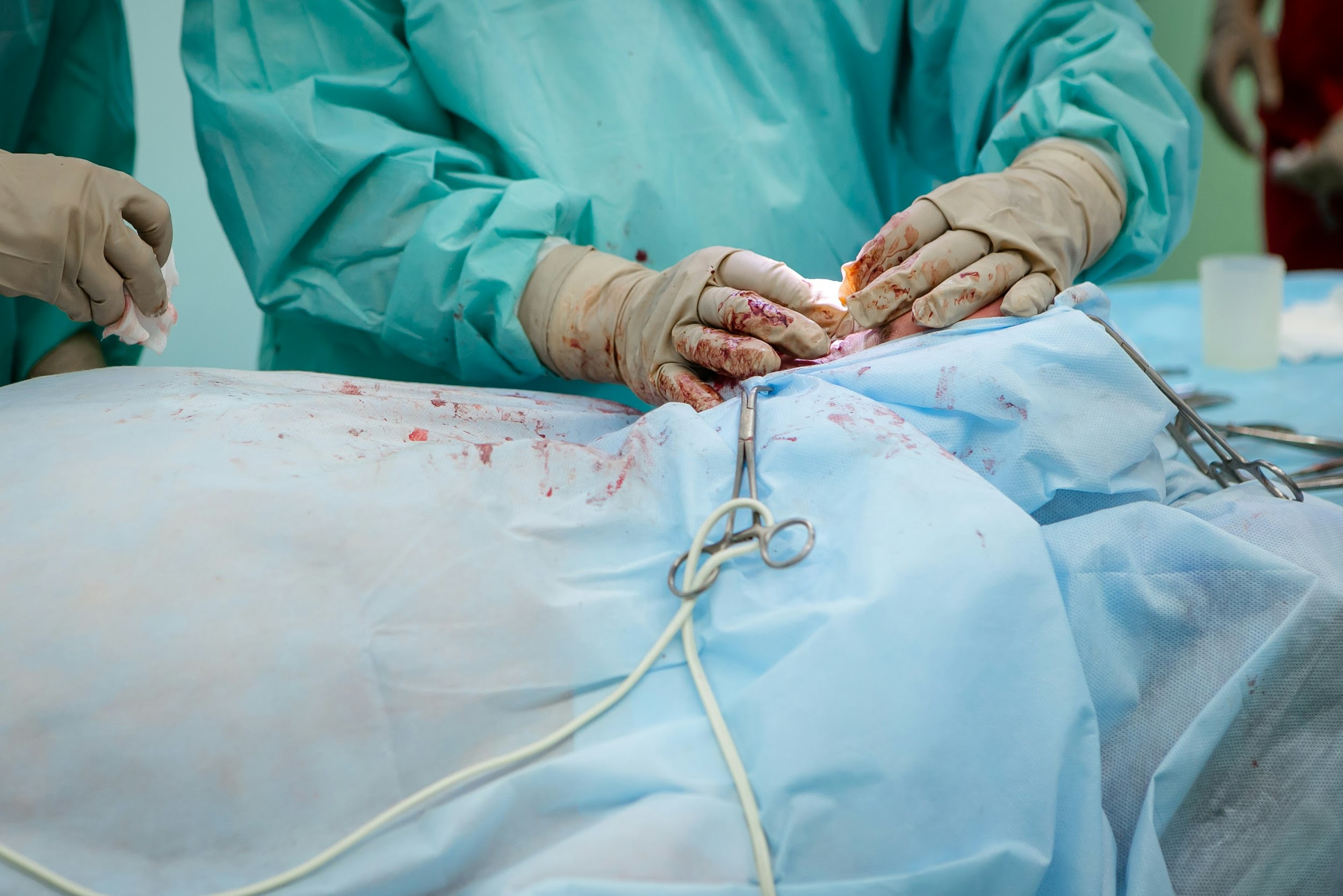 Best Practices for Minimizing Risk in Amputation Surgery