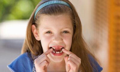 The Importance of Replacing Missing Front Teeth: A Comprehensive Guide