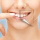 The Secret to a Stunning Smile: Dental Implants Before and After