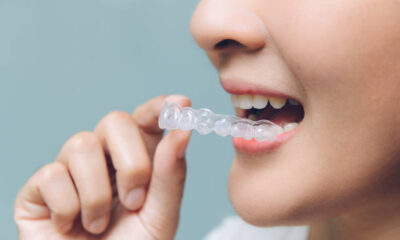 Why Invisalign Is London's Top Choice for Orthodontic Treatment