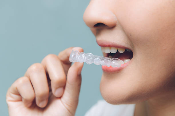 Why Invisalign Is London's Top Choice for Orthodontic Treatment
