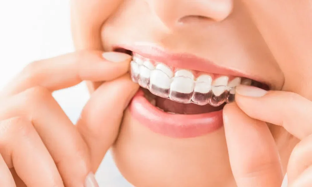 The Clear Path to a Perfect Smile: Enhancing Dental Health with Orthodontic Expertise