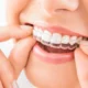 The Clear Path to a Perfect Smile: Enhancing Dental Health with Orthodontic Expertise