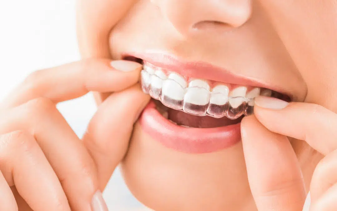 The Clear Path to a Perfect Smile: Enhancing Dental Health with Orthodontic Expertise