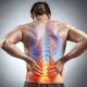 Sciatica Solutions Explained: Alleviate Nerve Pain with Physical Therapy